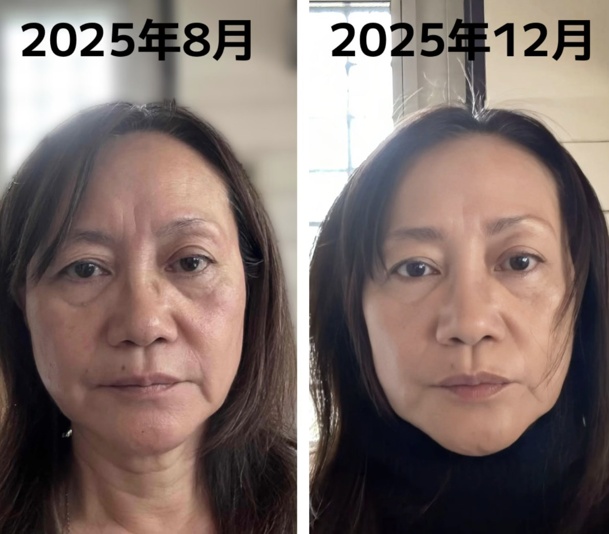 せとみか ビフォーアフター
